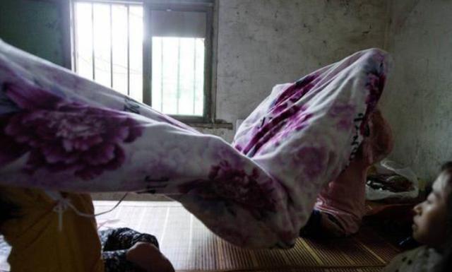 重庆“盆栽娃娃”：身高80厘米，平均每月骨折一次，睡觉不敢翻身