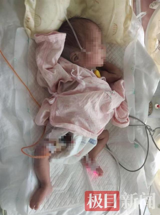 未婚女子去世留下早产女婴，朋友筹25万元治疗反被质疑是孩子生父：“我可以验DNA”