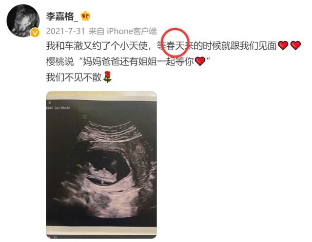 歌手李嘉格官宣二胎得子，晒母子合影超温馨，取名核桃长相随车澈