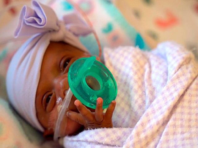 美国女婴出生时体轻如苹果，成为世界最小存活婴儿