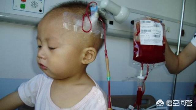 为什么孩子生命垂危，医院却不建议同血型父母输血？