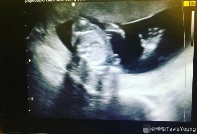 杨怡6个月胎儿性别被港媒曝光，乳名“小罗白”，罗仲谦将陪产