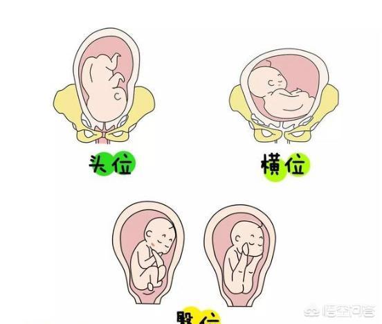 为了所谓的金猪宝宝，医生建议年前剖宫产了，可以忍着到年后剖宫产吗？
