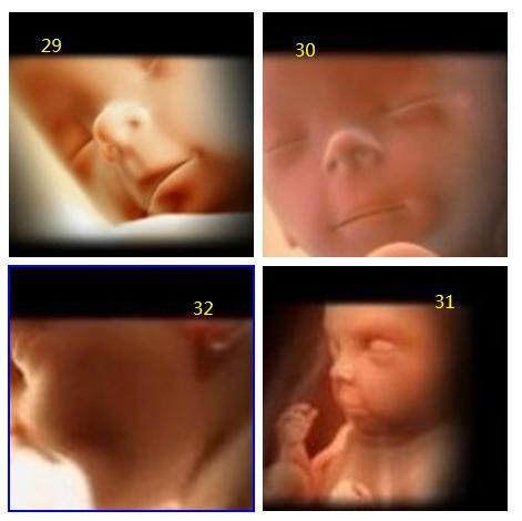1-40周胎宝宝详细发育过程，这些图片，让人看到生命的神奇与伟大