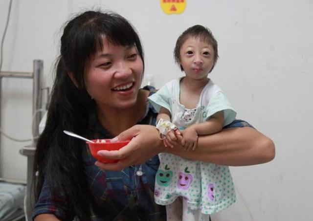 23年前，湖南女子生下重2斤的“小猴子”，马戏团出价5万求购被拒