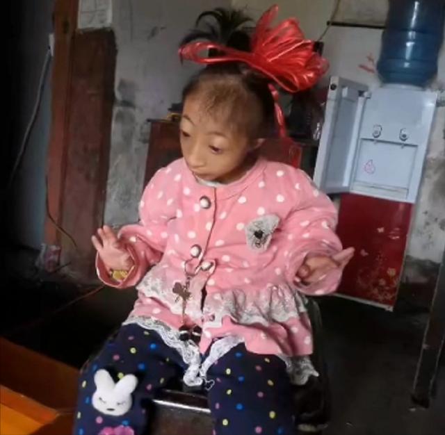23年前，湖南女子生下重2斤的“小猴子”，马戏团出价5万求购被拒