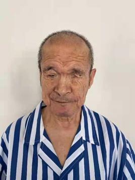 寻亲：河南商丘六旬老人在北京被救助，左眼不能睁开，高1米67