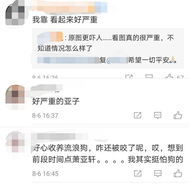 42岁曹格被狗咬伤，地上大片血迹惹人忧，网友却在嘲讽另一女星？